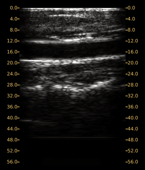 Image of Ultrasound Scan 1