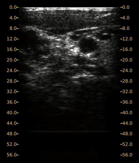 Image of Ultrasound Scan 2